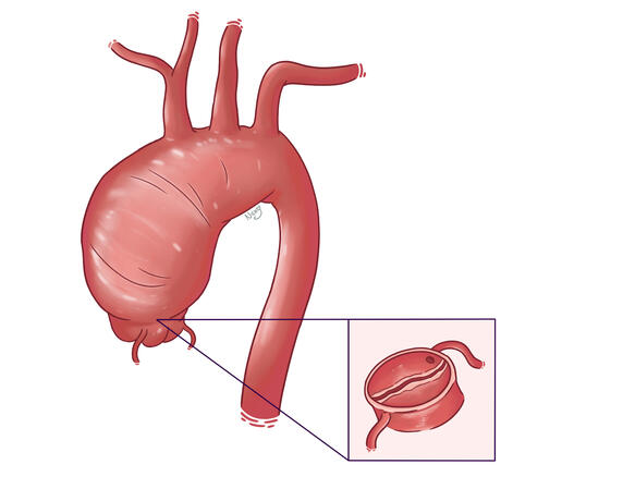 my first ever commission; featured in a published medical journal! (2021)